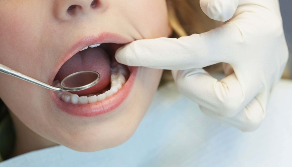 Perchè il bambino ha i denti storti? Come si può intervenire? 