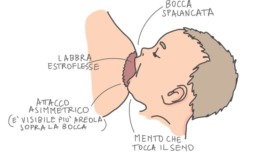 Corretta posizione per evitare ragadi del capezzolo