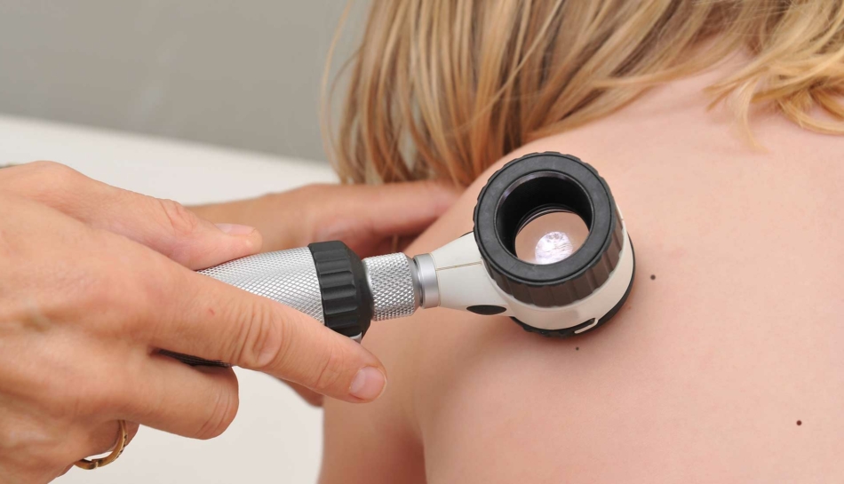 Visita dei nei a una bambina con un dermatoscopio