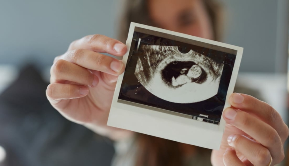 Ecografia del feto in gravidanza