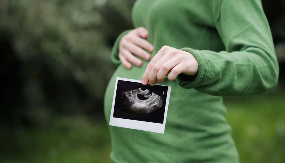 Donna in gravidanza che tiene l'ecografia del bambino davanti alla pancia