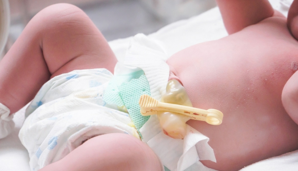 Primo piano del moncone ombelicale medicato