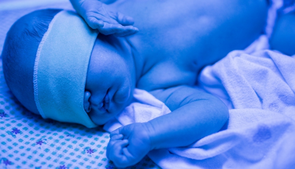 Trattamento per l'ittero neonatale