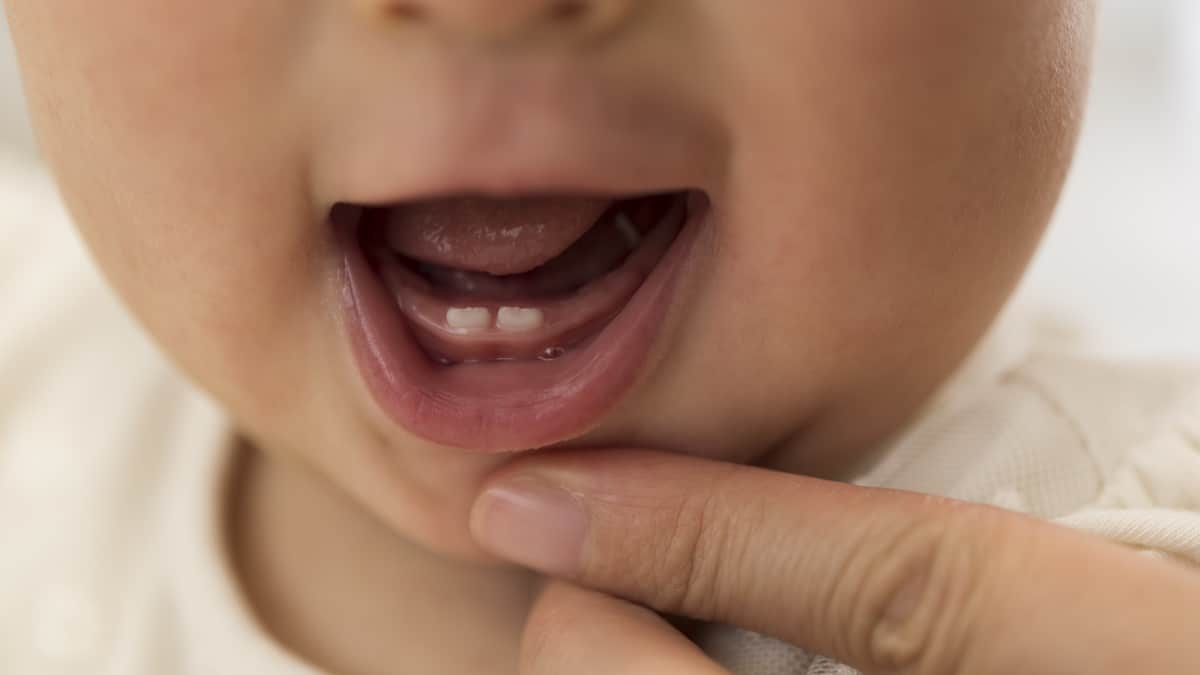 Dentizione nei bambini: sintomi e quando inizia - Uppa