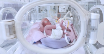 neonato nato prematuro in incubatrice