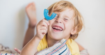 bambino con bruxismo mostra bite dentale