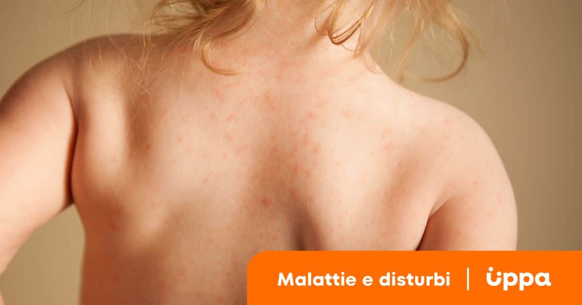 corpo caldo senza febbre bambini forum