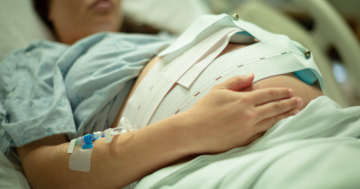 donna in gravidanza con apparecchio per cardiotocografia