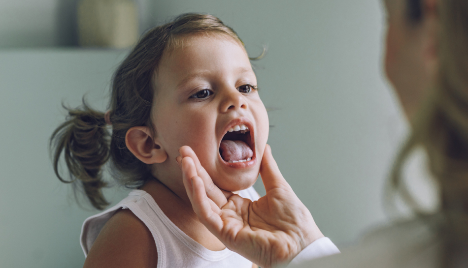 Bambina con placche alla gola