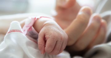 neonato con fossetta sacrale