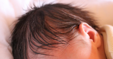 perdita dei capelli del neonato
