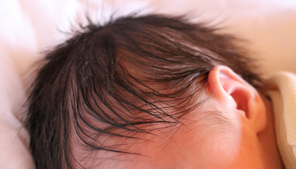 perdita dei capelli del neonato