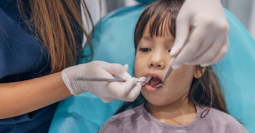 Bambina effettua la sigillatura dei denti