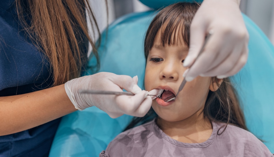 Bambina effettua la sigillatura dei denti