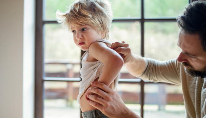 Bambino con allergia agli acari