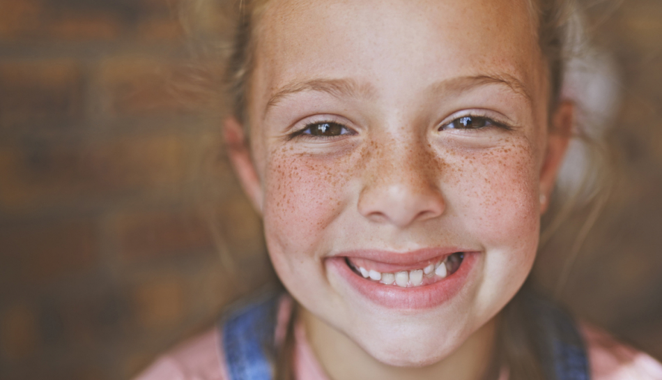 Bambina con lentiggini