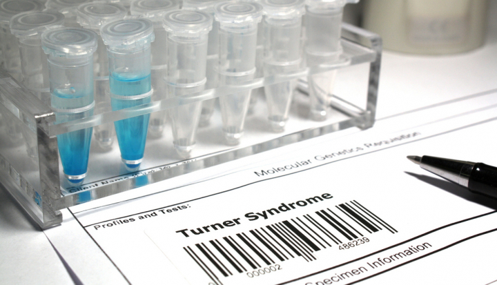 Test in laboratorio per la sindrome di Turner