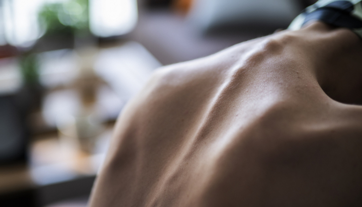 Dettaglio della schiena di una adolescente che soffre di anoressia