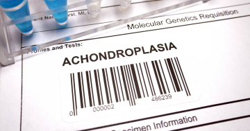 Ricerca genetica sulla acondroplasia