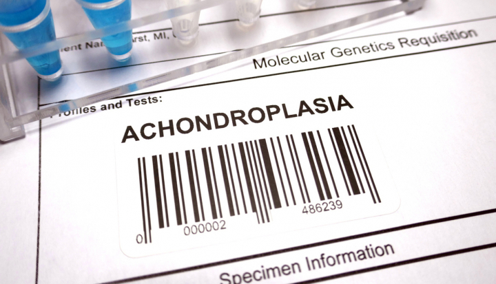 Ricerca genetica sulla acondroplasia