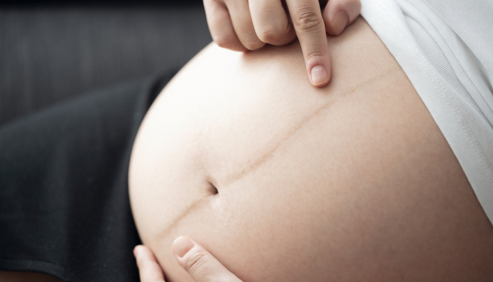 Donna in gravidanza indica la linea nigra sulla pancia